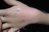 Bed Bugs Breakfast Lunch Dinner Bed Bugs Breakfast Lunch Dinner