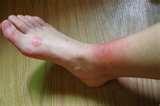 pictures of Bed Bugs Breakfast Lunch Dinner pictures of Bed Bugs Breakfast Lunch Dinner