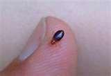 images of Bed Bugs Iowa 2010