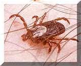 Bed Bugs Scalp images