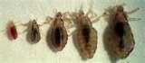 Bed Bugs Scalp pictures
