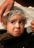 photos of Bed Bugs Scalp