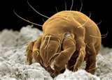 images of Bed Bugs Eat Hair