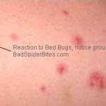 Bed Bugs 2nd Treatment Bed Bugs 2nd Treatment