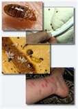 pictures of Bed Bugs Sg pictures of Bed Bugs Sg