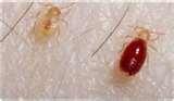 How Do You Get Rid Of Bed Bugs By Yourself