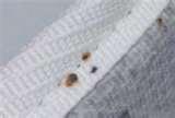 Bed Bugs San Francisco