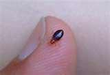 Bed Bugs Bites Pictures photos