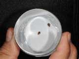 Bed Bugs Denver pictures