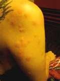 Photos Of Bed Bug Bites pictures