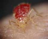 photos of Bed Bugs Denver