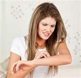 images of Bed Bugs Wiki