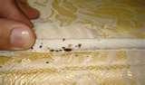 photos of Bed Bugs Ny