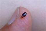 Bed Bugs Images