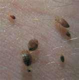 Does Steam Kill Bed Bugs
