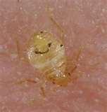 pictures of Bed Bugs In Nyc