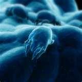 How Kill Bed Bugs photos