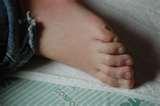 Where Do Bed Bugs Live images Where Do Bed Bugs Live images