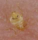 pictures of Bed Bugs Exterminators