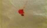 Bed Bug Service
