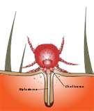 Treatment For Bed Bugs images
