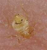 Bed Bugs Solutions images