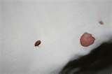 Bed Bug Sheets pictures