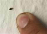 How Do I Kill Bed Bugs pictures