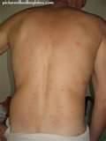 How To Rid Bed Bugs images