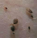 Different Types Of Bed Bugs pictures