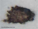 How To Spot Bed Bugs