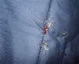 pictures of Checking For Bed Bugs