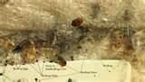 images of Checking For Bed Bugs