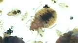 images of How To Spot Bed Bugs