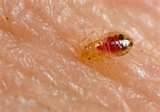 How You Get Bed Bugs photos How You Get Bed Bugs photos