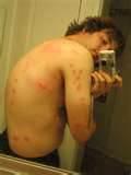 How You Get Bed Bugs pictures How You Get Bed Bugs pictures