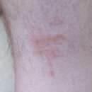 Different Types Of Bed Bugs pictures