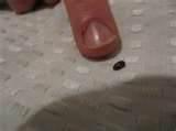 pictures of Exterminator For Bed Bugs