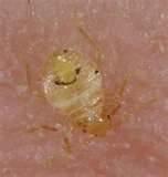 How To Eradicate Bed Bugs images