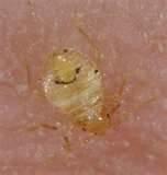 Heat Bed Bugs photos