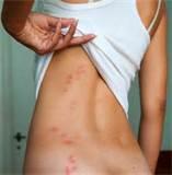 How To Test For Bed Bugs