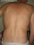 photos of How Get Rid Of Bed Bugs