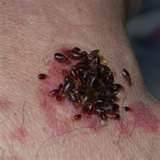 How To Protect Against Bed Bugs