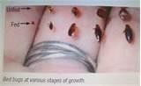 photos of Bed Bug Chemicals