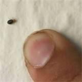 photos of Eliminate Bed Bugs
