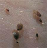 Finding Bed Bugs images