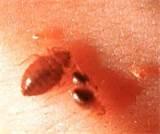 Finding Bed Bugs images