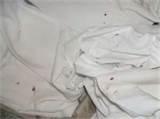 On The Avenue Hotel Bed Bugs