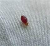 Milford Plaza Bed Bugs Photos