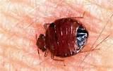Bed Bug Pics